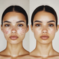 The Most Advanced LED Light Therapy Face Mask